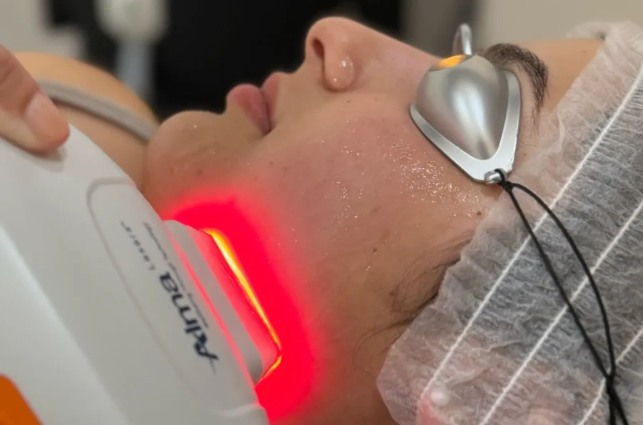 rejuvenecimiento laser la orotava