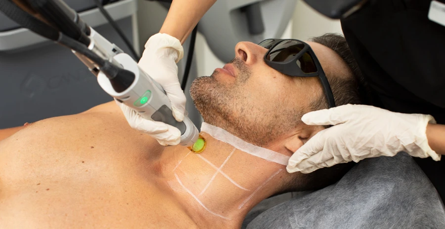 depilacion laser precios la orotava