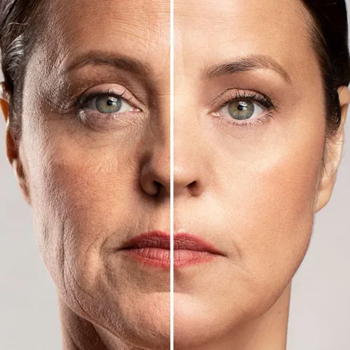 skin booster precio