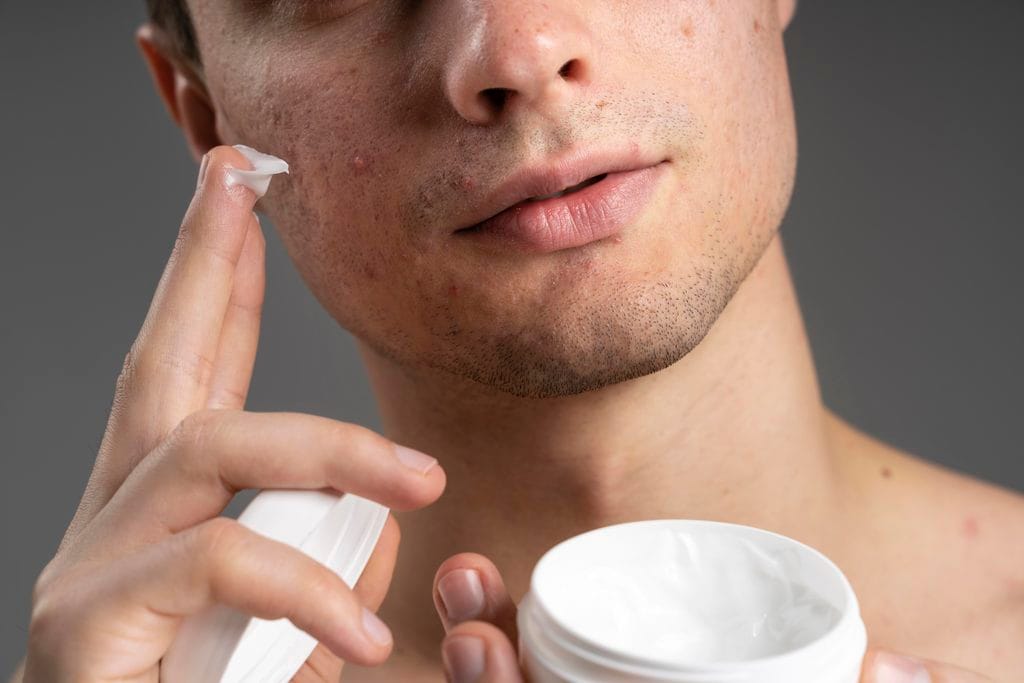 Piel con tendencia acneica y cuidado facial